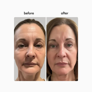 Wavy Pro LED Therapy Mask