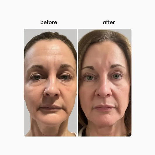Wavy Pro LED Therapy Mask