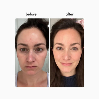 Wavy Pro LED Therapy Mask