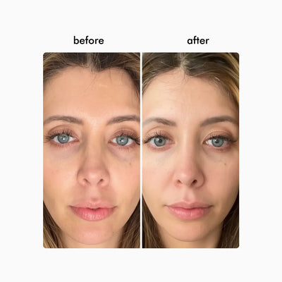 Wavy Pro LED Therapy Mask