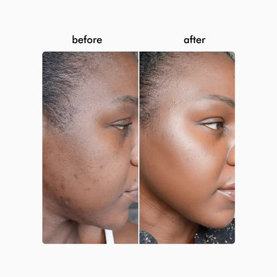 Wavy Pro LED Therapy Mask